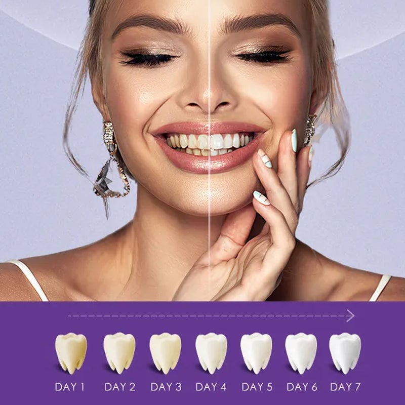 V34 Whitening Strips