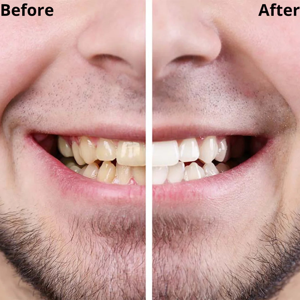 V34 Whitening Strips