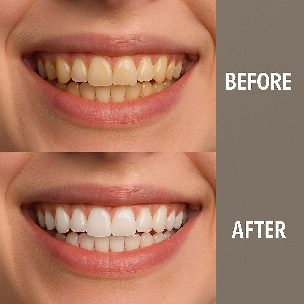 V34 Whitening Strips
