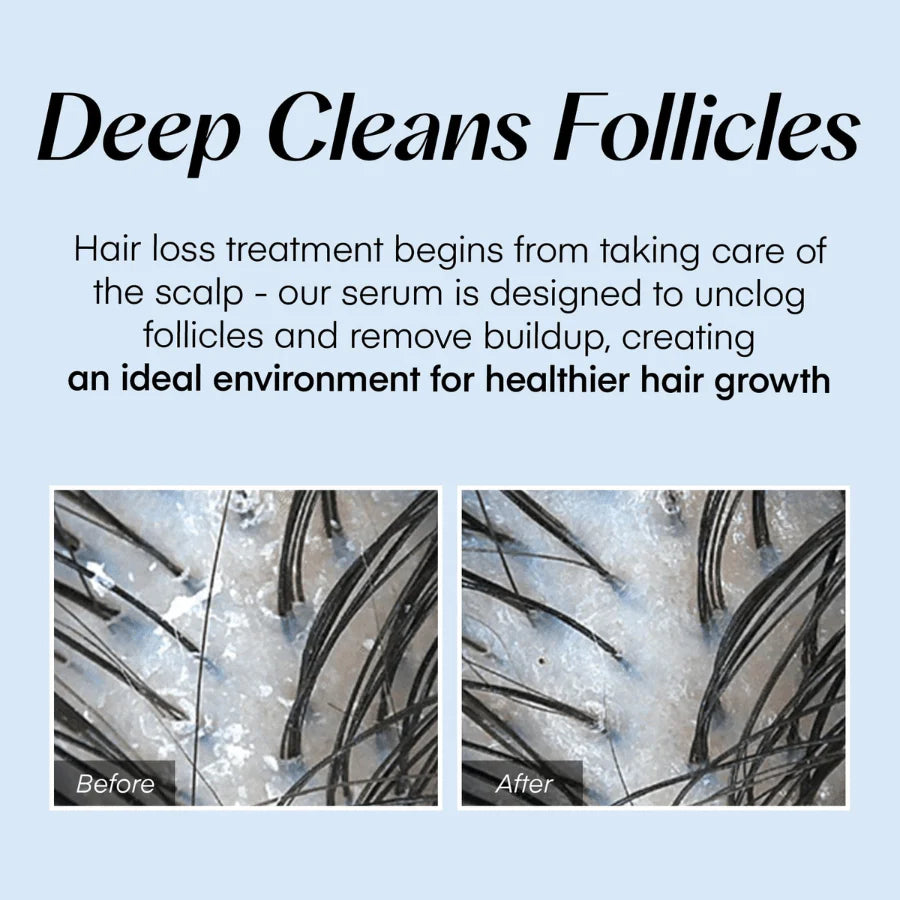 Scalpy™ Hair Serum