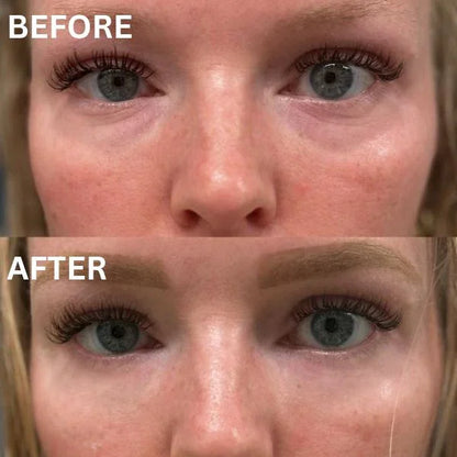 InstantFirm Eye Patches