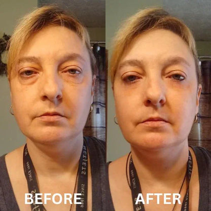 InstantFirm Eye Patches