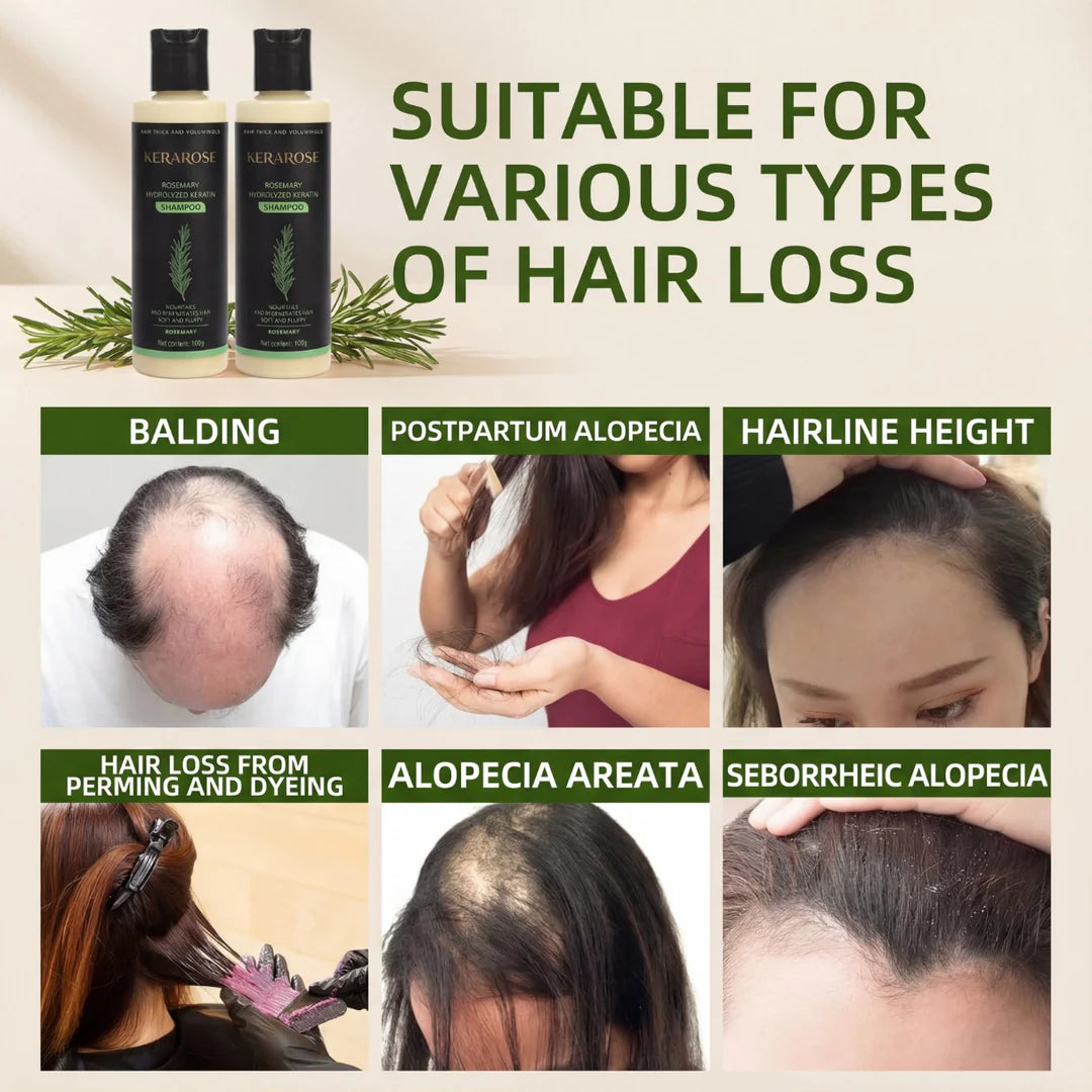 Kerarose Rosemary Shampoo