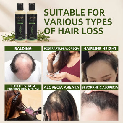 Kerarose Rosemary Shampoo