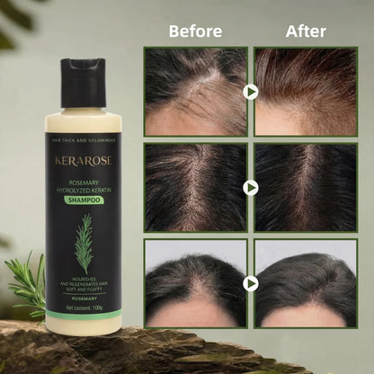 Kerarose Rosemary Shampoo